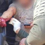 Elementos de Protección Civil realizaron curaciones a masculino detenido por policía municipal de Pinal de Amoles